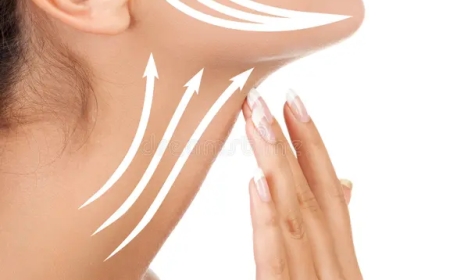 Non-Surgical Neck Lift in Beverly Hills: A Modern Approach to Timeless Beauty