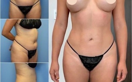 Best Body Contouring Surgeon in Dubai: Helping You Achieve a Toned Physique
