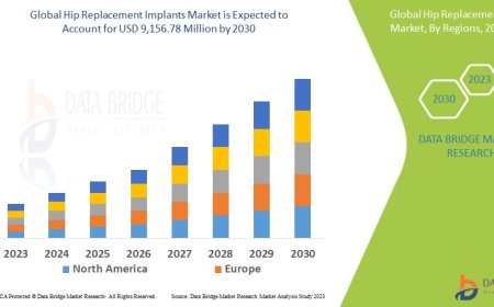Hip Replacement Implants Market Overview: Key Drivers and Challenges