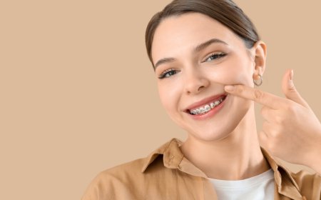 Start Your Journey to a Perfect Smile with Braces