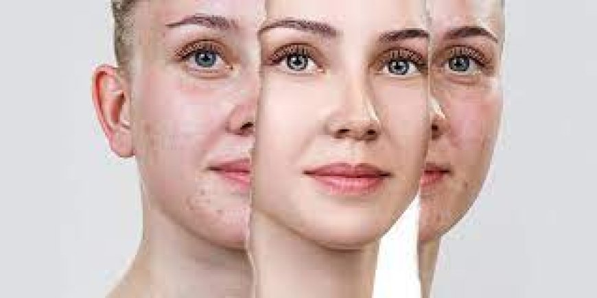 Acne Treatment Clinic in Bangalore – Clear Skin Starts Here