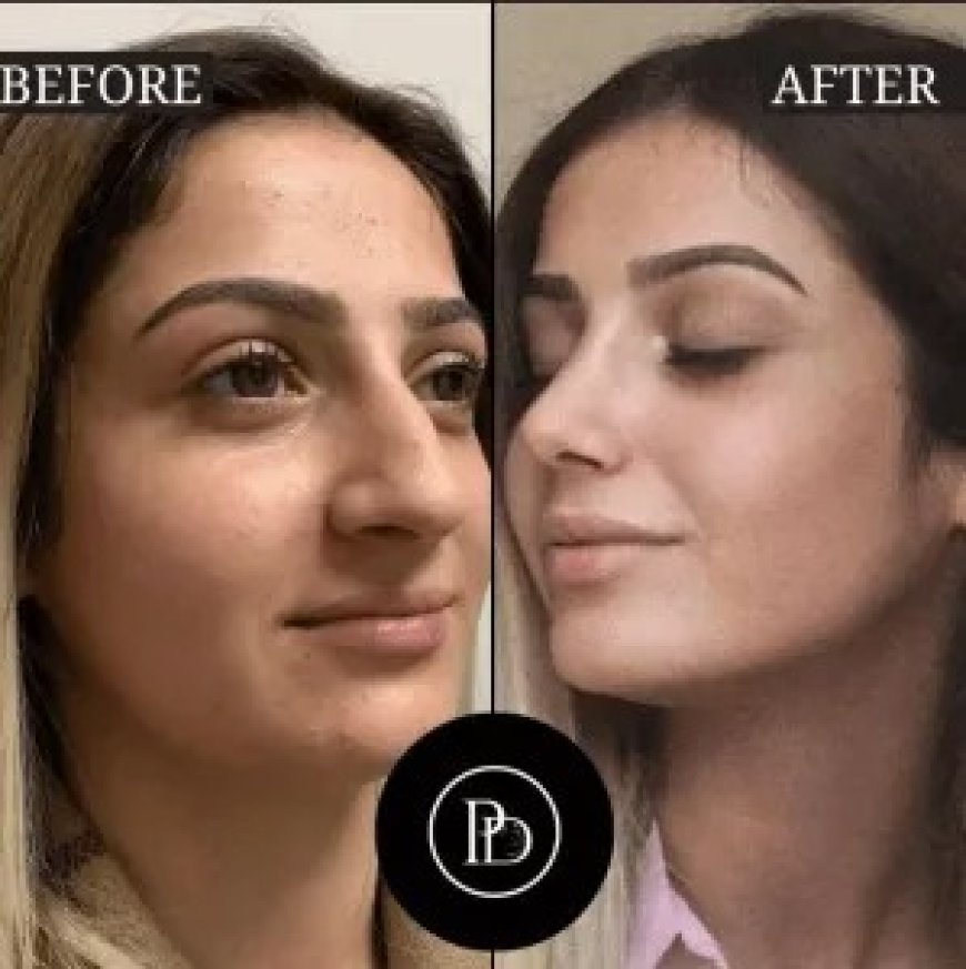 Looking for the Best Plastic Surgeon in Dubai? Here’s What I Learned