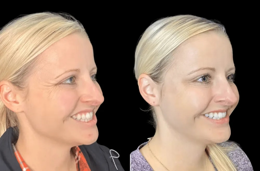 How Botox in Dubai Fits into the Wellness and Beauty Lifestyle